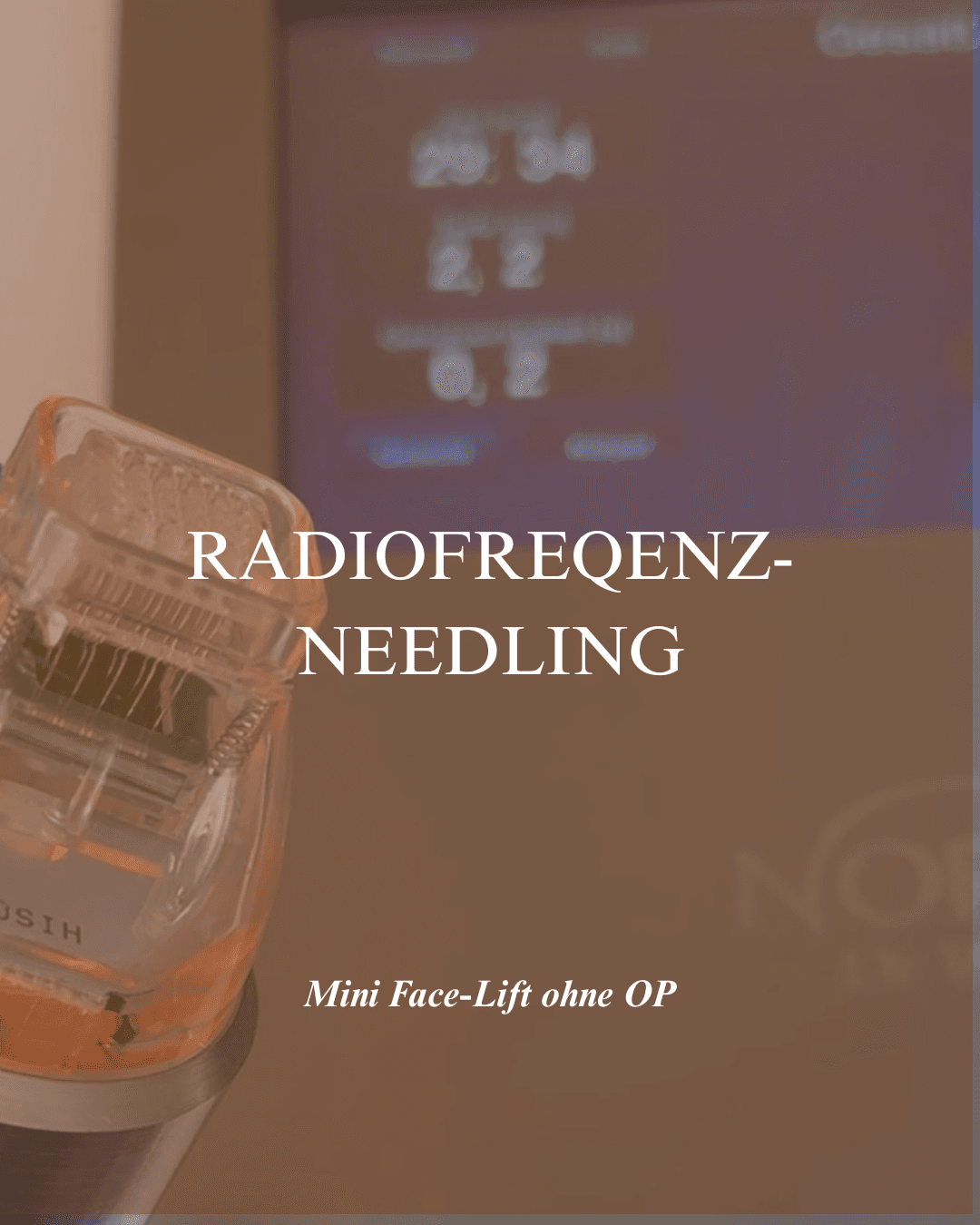 RF-Needling